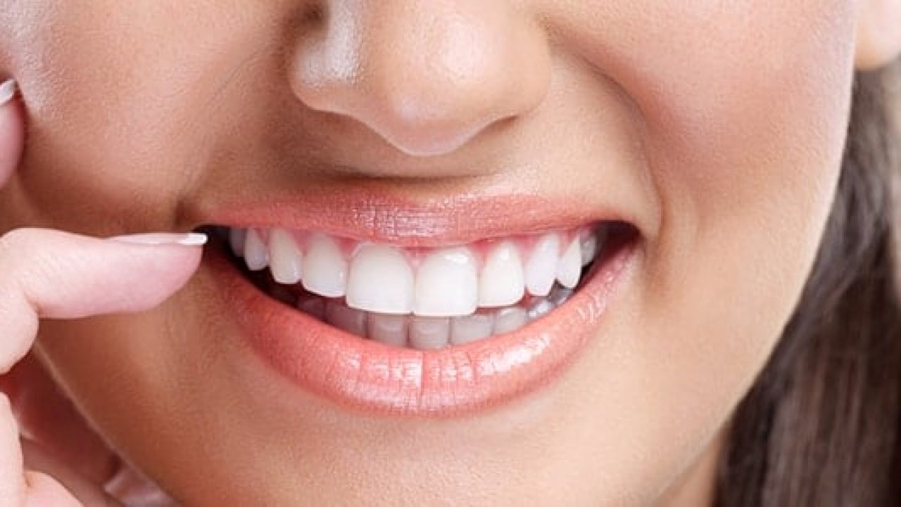 What Are the Top Advantages of Dental Implants?