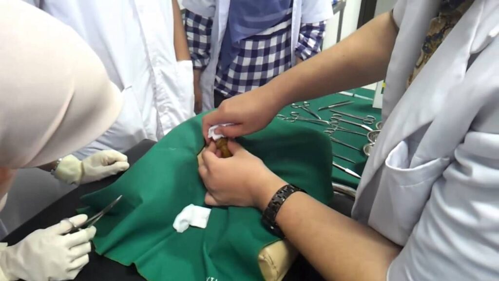Circumcision