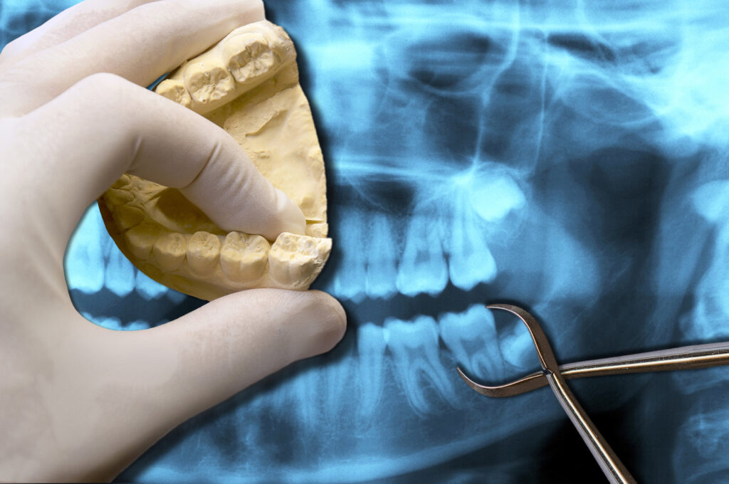 How Many Teeth do Humans have