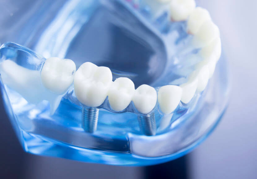 Dental Treatments